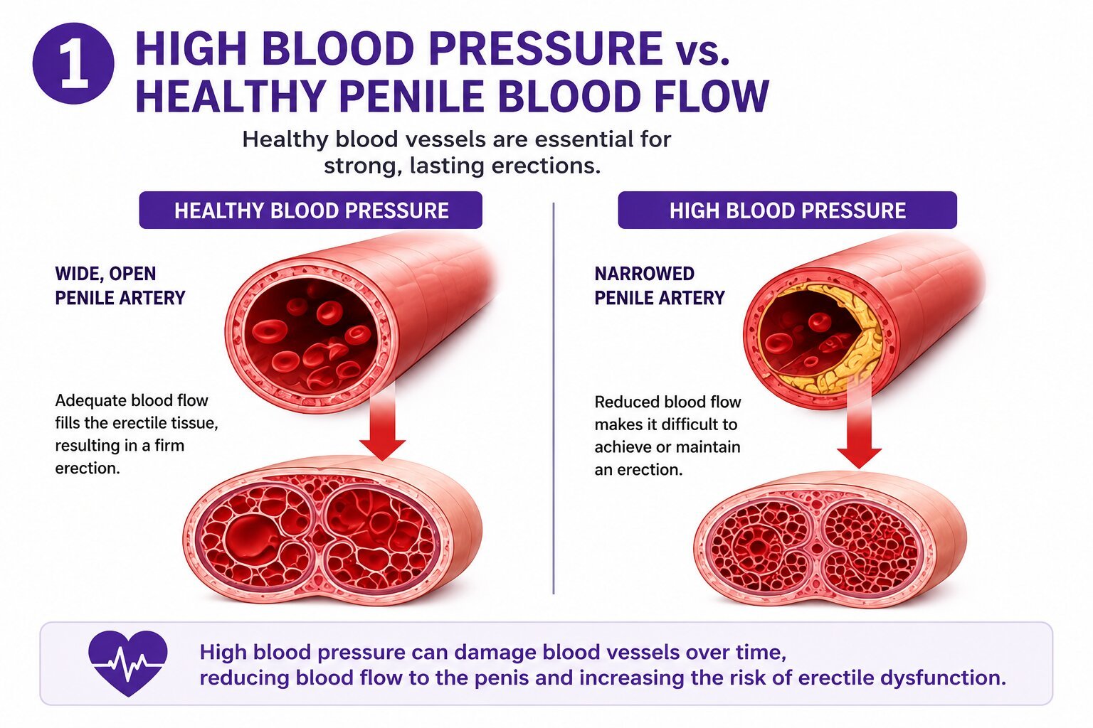 Conceptual medical illustration of a heart and blood vessels showing the link between cardiovascular health, blood pressure, and men's sexual wellness